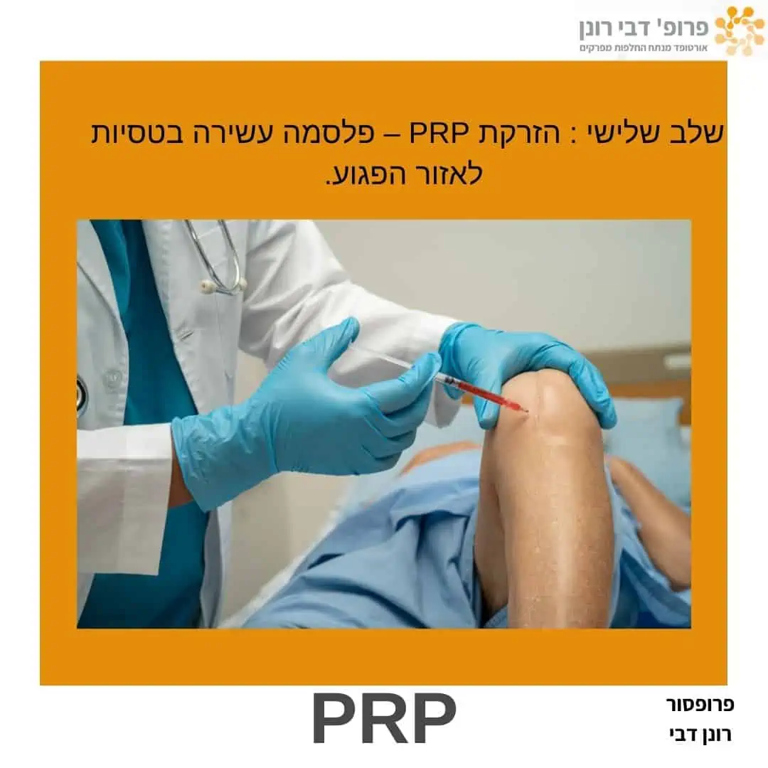טיפול טבעי: הזרקת PRP לברך, שלב 3