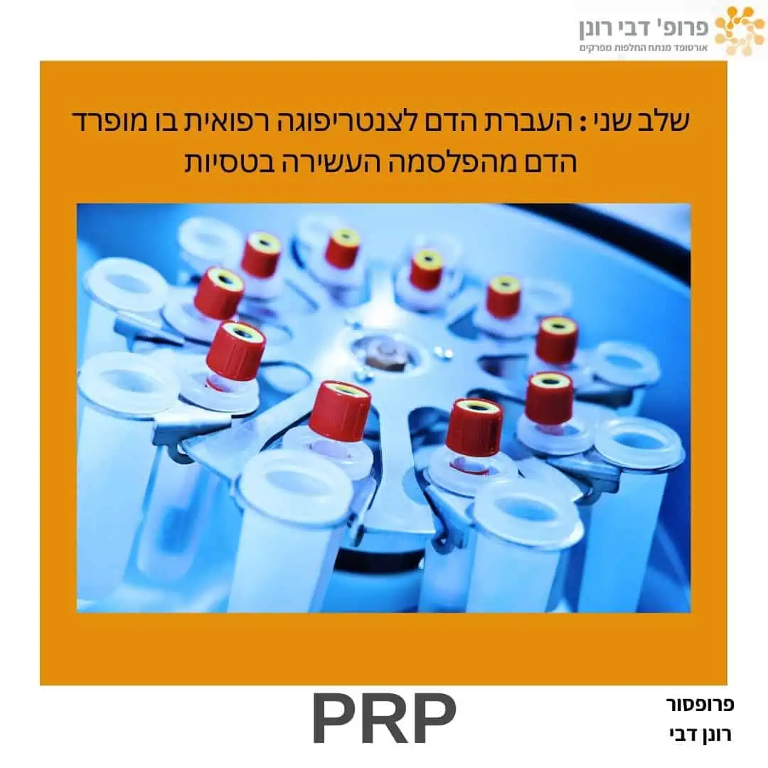 טיפול טבעי: הזרקת PRP לברך, שלב 2