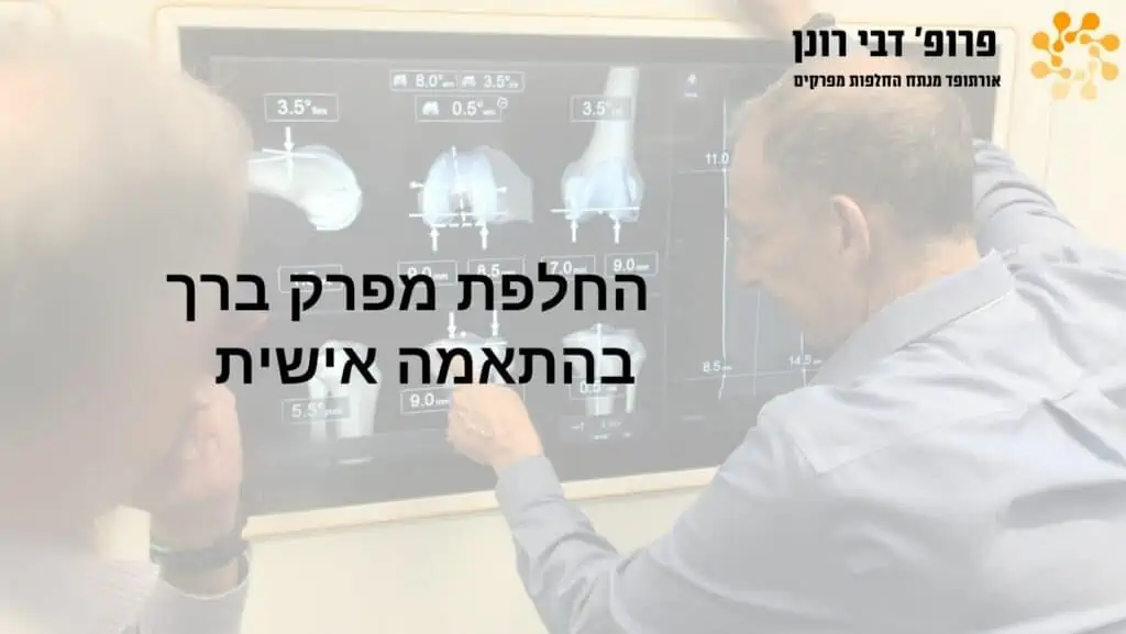 החלפות מפרקים , רונן דבי - החלפת מפרק ברך בהתאמה אישית