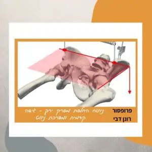 ניתוח החלפת מפרק ירך -הדפסת שתלים, גישה קדמית ומערכת ניווט