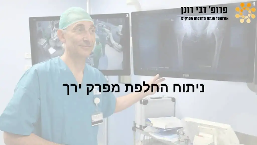 ניתוחי החלפת ירך וברך בהובלת פרופ' רונן דבי, מומחה להחלפות מפרקים