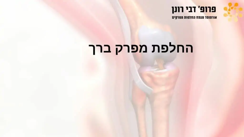 ניתוחי החלפת ירך וברך בהובלת פרופ' רונן דבי, מומחה להחלפות מפרקים